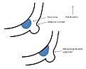 Click image for larger version

Name:	draft angle diagram..jpg
Views:	201
Size:	21.1 KB
ID:	92235